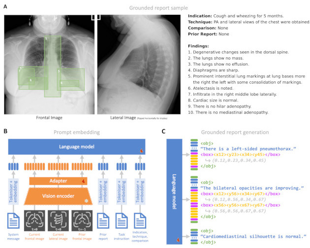 MAIRA-2: Grounded Radiology Report Generation