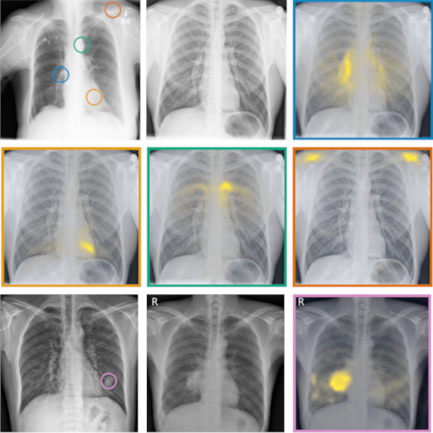 Exploring scalable medical image encoders beyond text supervision