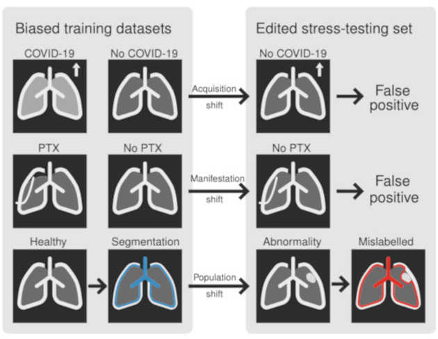 RadEdit: stress-testing biomedical vision models via diffusion image editing